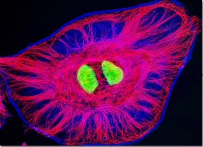 Proteínas do citoesqueleto evidenciadas por fluorescência. 