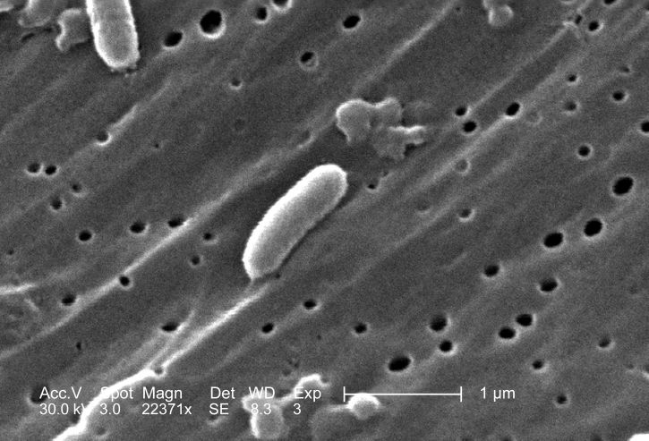 Vibrio Cholerae (Microscopia eletrónica)