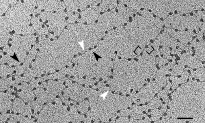 Figure 1 – DNA associated with proteins, forming the nucleosome, in the first level of chromatin compaction (11nm fibers). Optical microscopy image, where white arrows show DNA strands between nucleosomes and black arrows show nucleosomes.