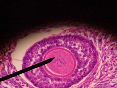 Figure 1 - Histological image of a primary follicle. The needle points to oocyte I, inside the follicle.