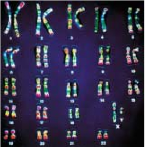 Figura 1 – Cariótipo humano. Pode observar-se 23 pares de cromossomas homólogos ordenados pelo seu tamanho. Adaptado de Raver & Johnson, 2002.