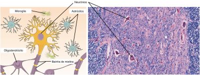 Figura 1 - Células constituintes do tecido nervoso. À esquerda as células são apresentadas de forma esquemática, à direita as células são apresentadas em imagem histológica.
