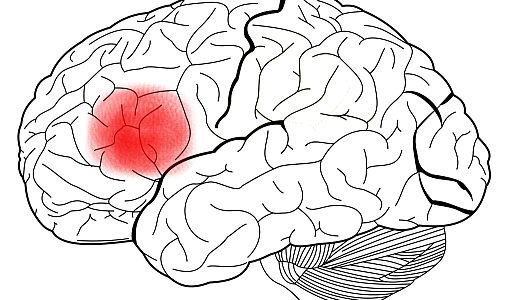 considerações sobre a área de Broca