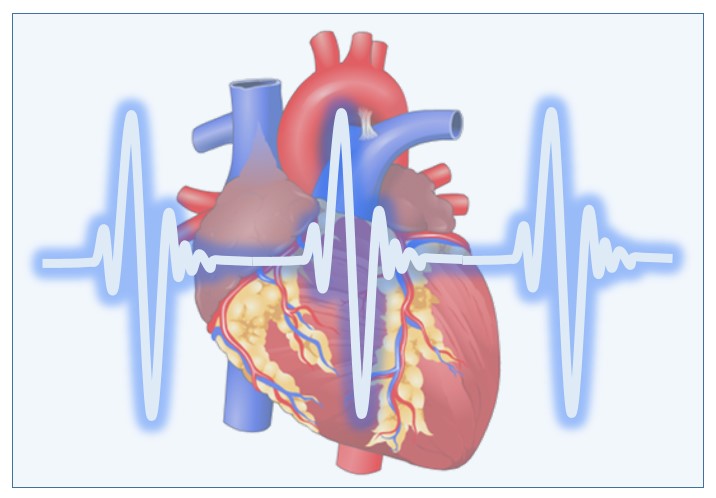 Arritmia Cardíaca